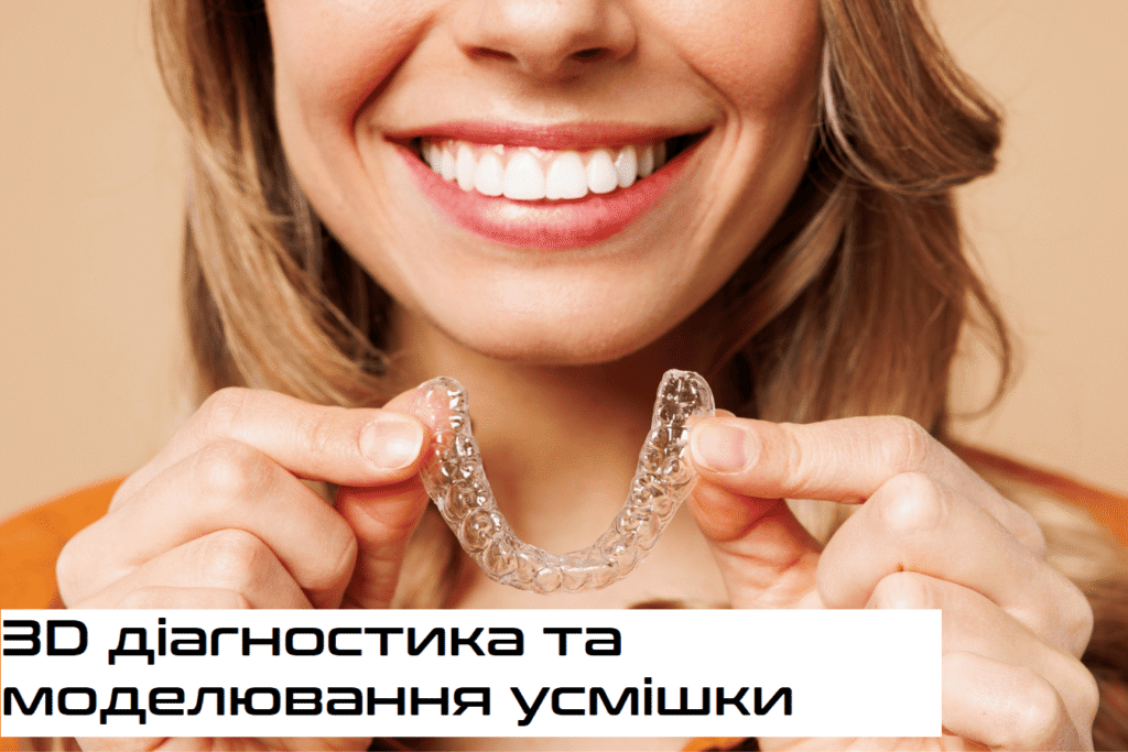 Врівнювання зубів елайнерами Хмельницький