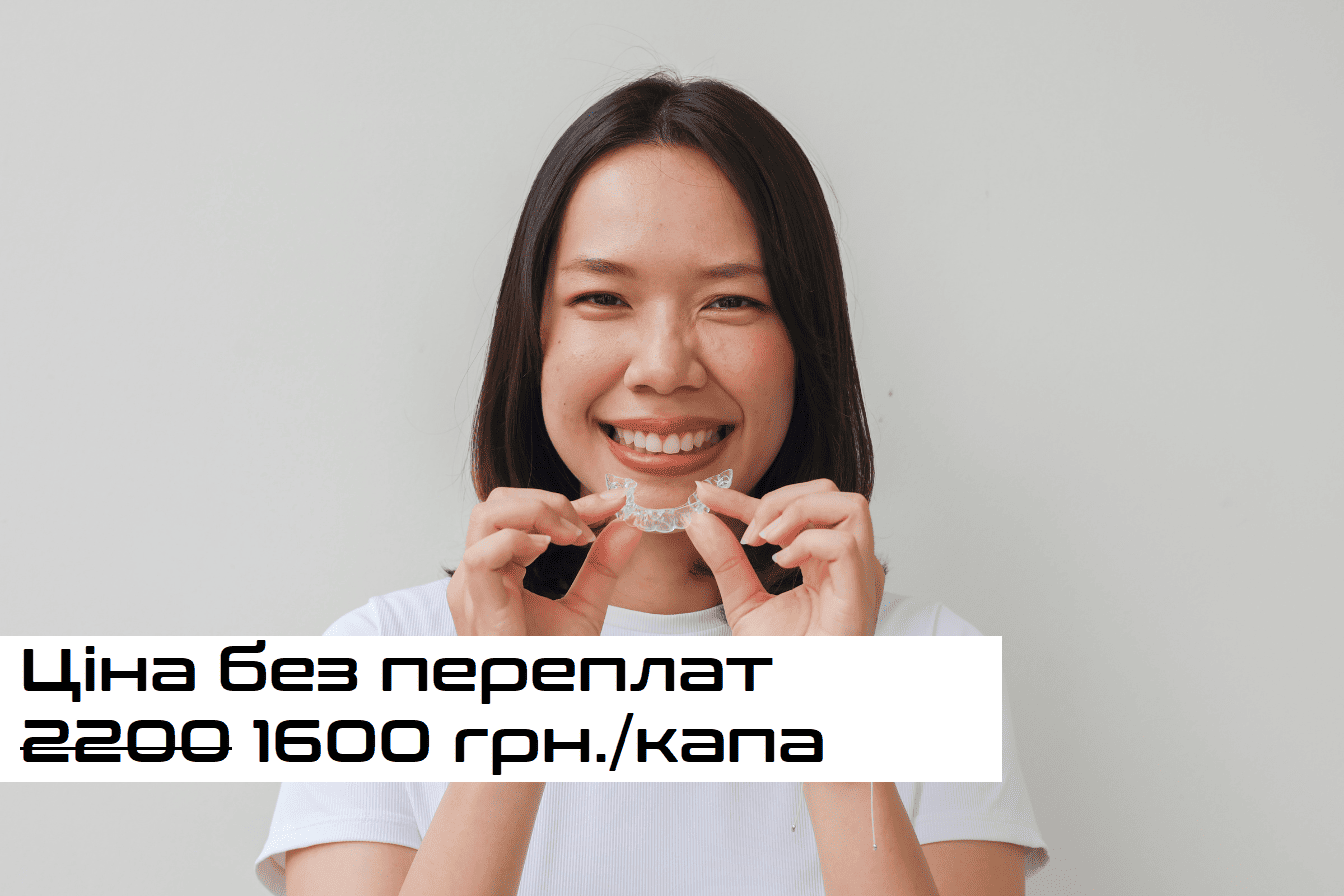 Встановити елайнери